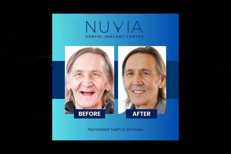 NUVIA Dental Implant Center Expands Into Tampa, Florida