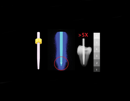 fiber posts