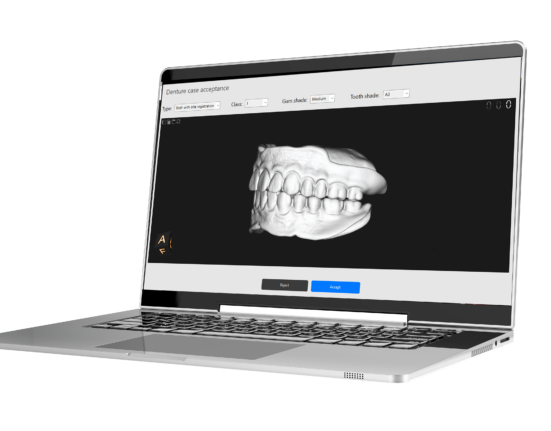 Easy Digital Denture Solution (EDDS)