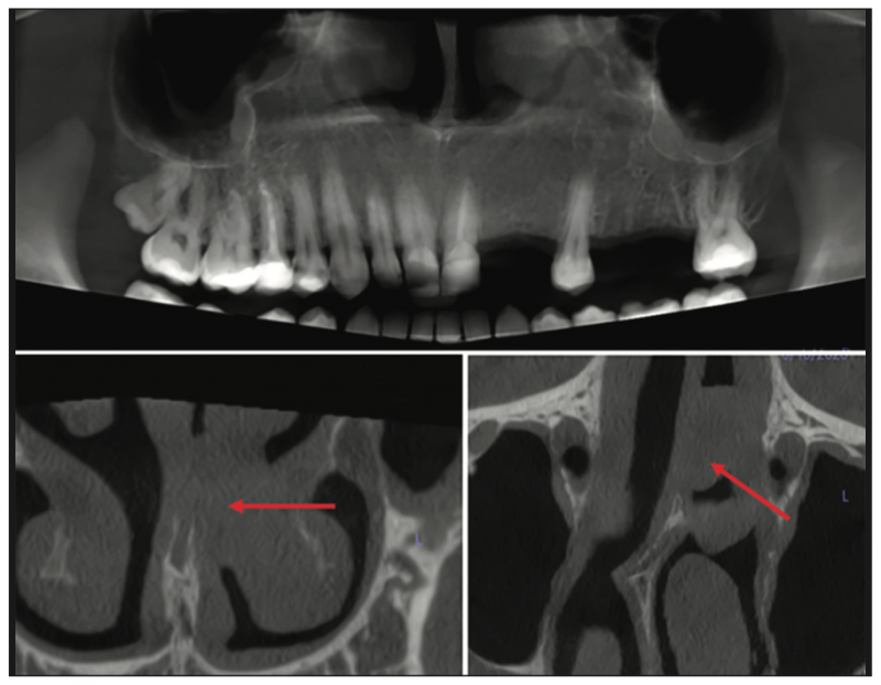 How to Read a CBCT Scan: Insights From an Oral and Maxillofacial ...