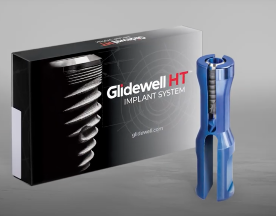 glidewell