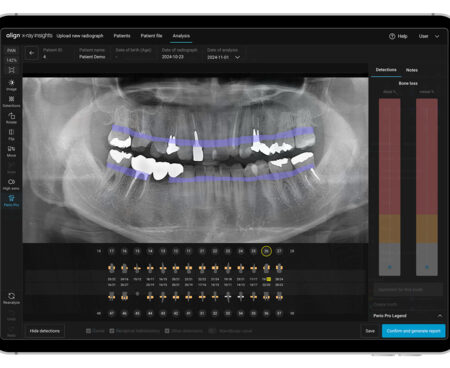 align technology