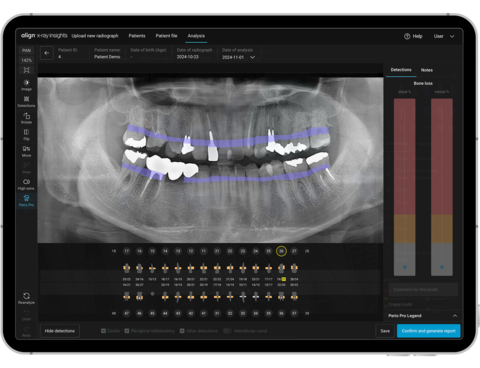 align technology